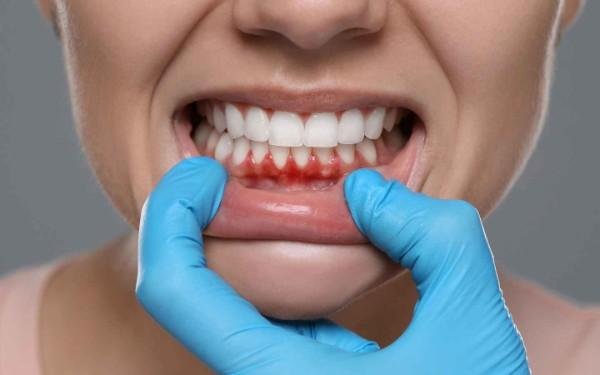 laster gum treatment